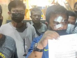 Ketum KNPI Laporkan Pengeroyokan Dirinya ke Polda Metro Jaya