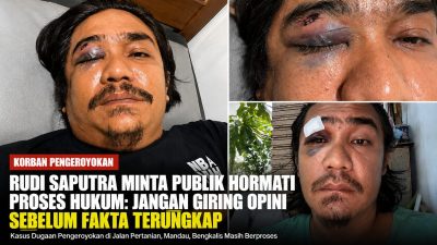 Rudi Saputra Tanggapi Pemberitaan Kasus Pengeroyokan, Minta Tidak Ada Opini Sepihak